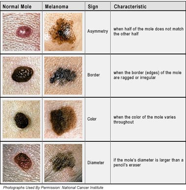 Melanoma Red